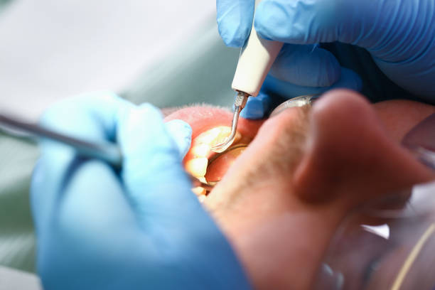 Best Pediatric Emergency Dentist in Crystal Lakes, OH