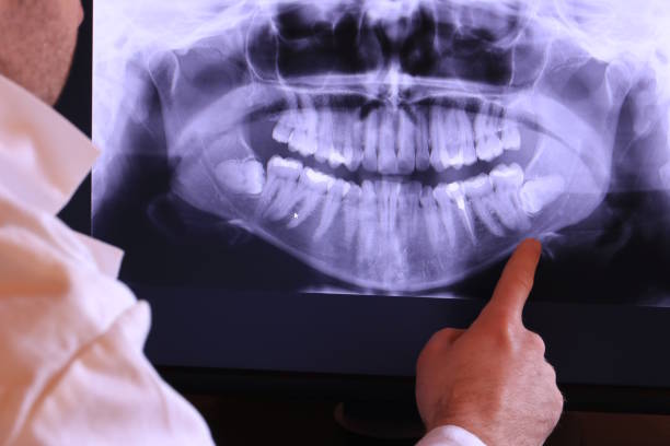 Best Emergency Treatment for Dental Infections or Abscesses in Crystal Lakes, OH