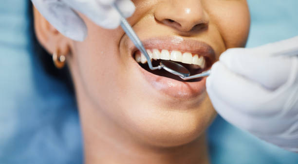 Best Emergency Tooth Extraction in Crystal Lakes, OH