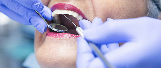 Best Emergency Tooth Extraction in Crystal Lakes, OH